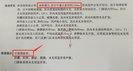 健康时报:11岁肝硬化、12岁脂肪肝,医生提醒,把孩子吃得白白胖胖,其实是害了孩子! 健康时报:11岁肝硬化、12岁脂肪肝,医生提醒,把孩子吃得白白胖胖,其实是害了孩子!